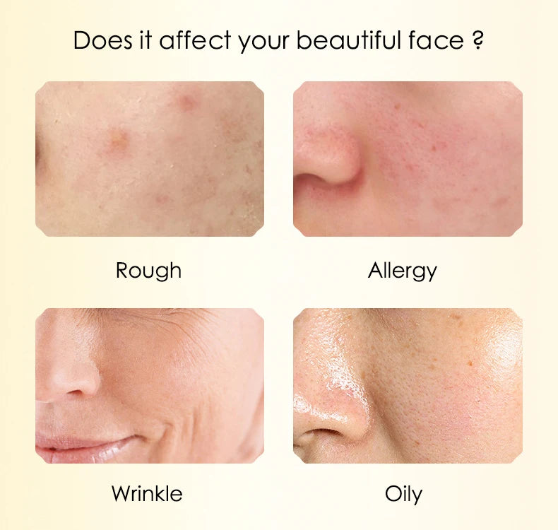 Snail & Hyaluronic Acid Face Sheet Mask – 10pcs | Korean Skincare