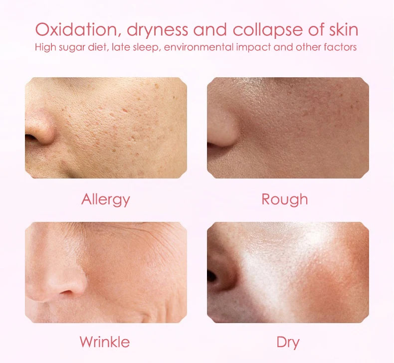 Snail & Hyaluronic Acid Face Sheet Mask – 10pcs | Korean Skincare