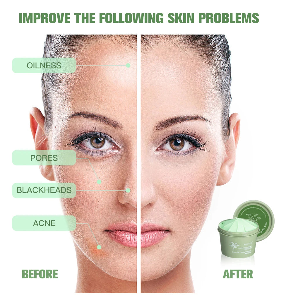 Green Tea Clay Mud Mask – 100g | Deep Cleansing & Pore Refining