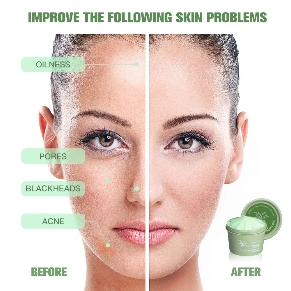 Green Tea Clay Mud Mask – 100g | Deep Cleansing & Pore Refining