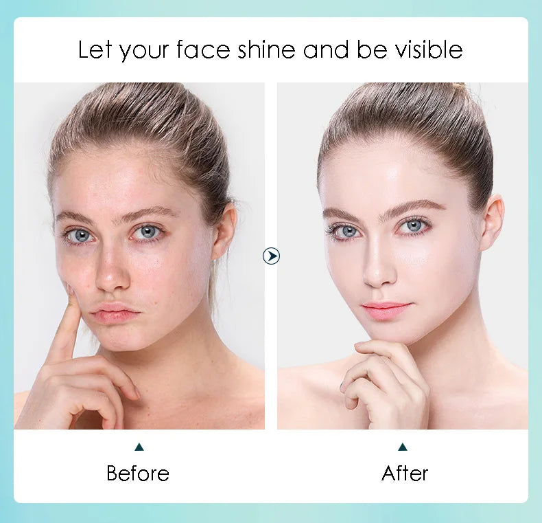 Snail & Hyaluronic Acid Face Sheet Mask – 10pcs | Korean Skincare